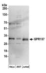 Detection of human GPR157 by western blot.