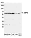 Detection of human G6PD by western blot.