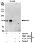 Detection of human FOXM1 by western blot of immunoprecipitates.
