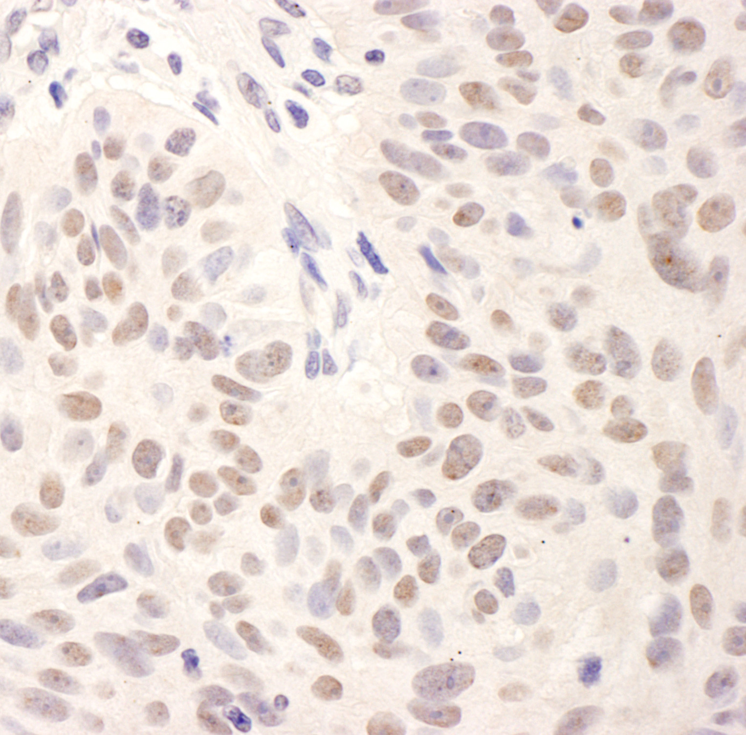 Rabbit anti-BMI1 IHC Antibody