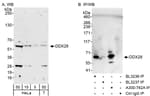Detection of human DDX28 by western blot and immunoprecipitation.