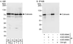 Detection of human Calnexin by western blot and immunoprecipitation.