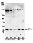 Detection of human and mouse RPL12 by western blot.