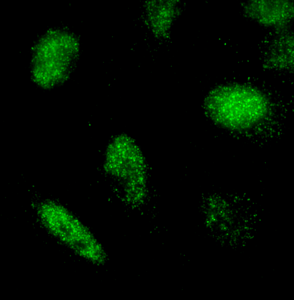 Detection of human RCOR3 by immunocytochemistry.