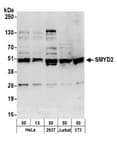 Detection of human and mouse SMYD2 by western blot.