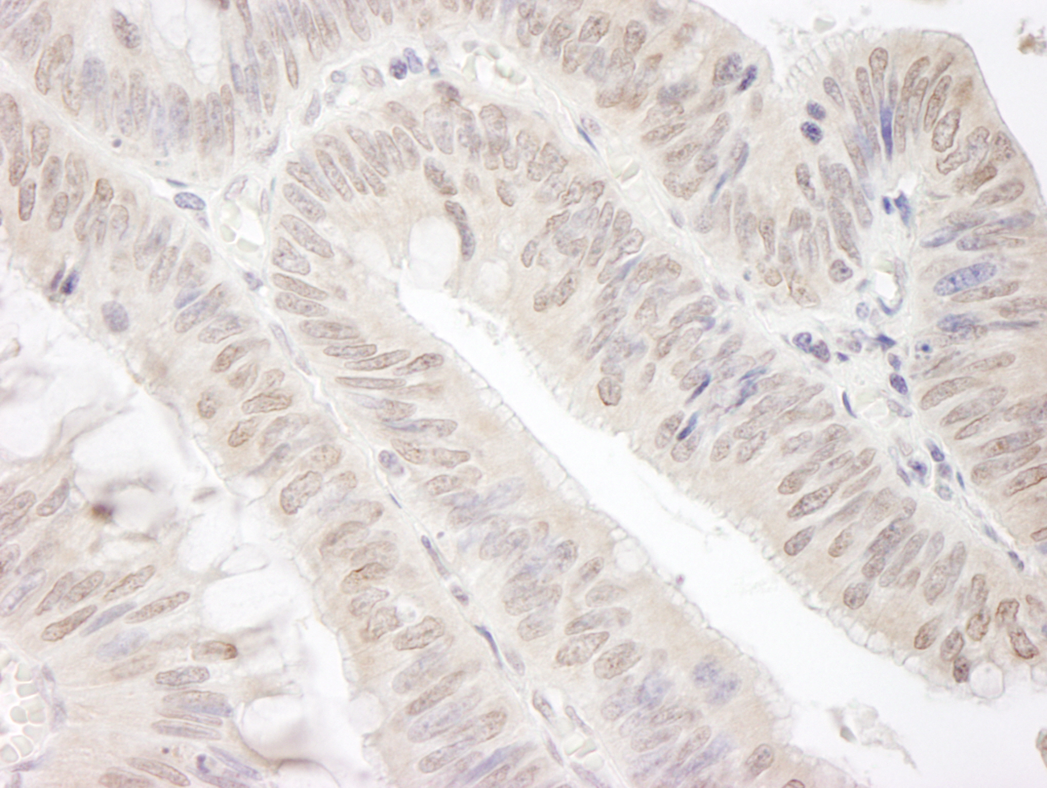 Rabbit anti-Gemin4 IHC Antibody