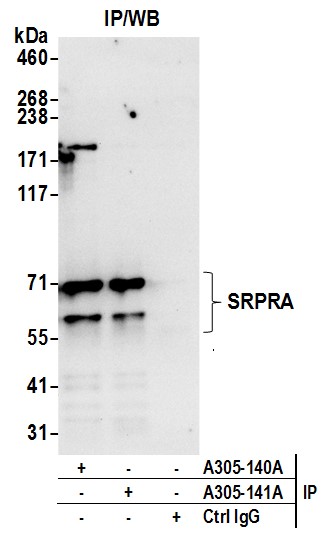 Detection of human SRPRA by western blot of immunoprecipitates.