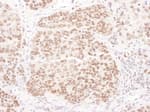 Detection of mouse PolD1 by immunohistochemistry.