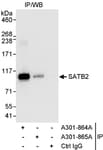 Detection of human SATB2 by western blot of immunoprecipitates.