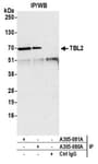 Detection of human TBL2 by western blot of immunoprecipitates.