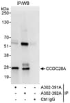 Detection of human CCDC28A by western blot of immunoprecipitates.