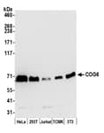 Detection of human and mouse COG6 by western blot.