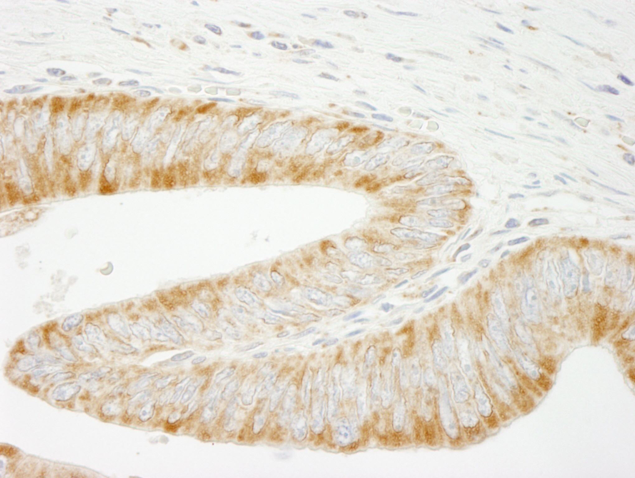 Rabbit anti-INPPL1/SHIP2 IHC Antibody