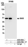 Detection of human SNX5 by western blot of immunoprecipitates.