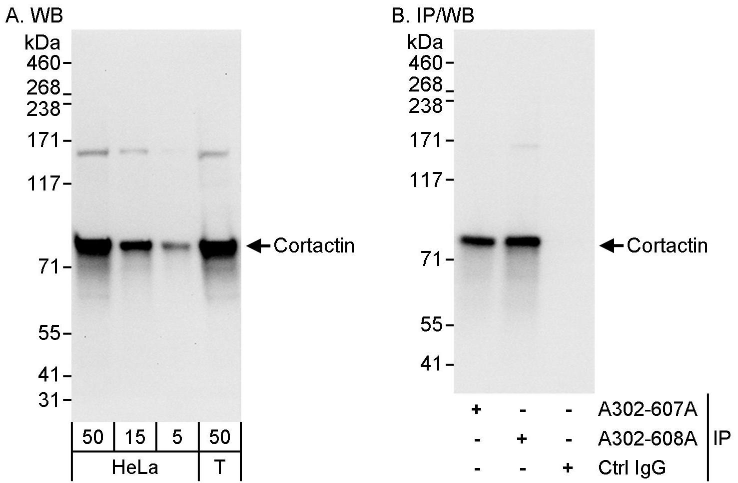 Detection of human Cortactin by western blot and immunoprecipitation.