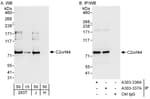 Detection of human C2orf44 by western blot and immunoprecipitation.