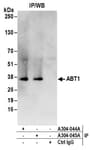 Detection of human ABT1 by western blot of immunoprecipitates.