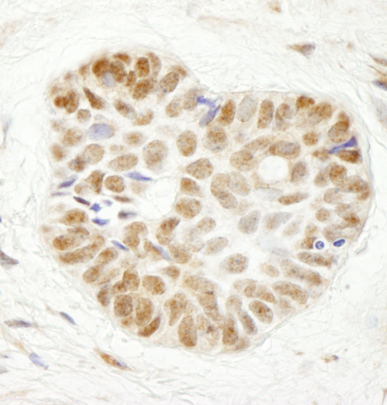 Rabbit anti-WDR79 IHC Antibody