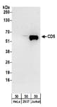 Detection of human CD5 by western blot.