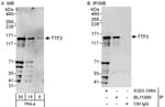 Detection of human TTF2 by western blot and immunoprecipitation.