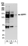 Detection of human ASPP1 by western blot.
