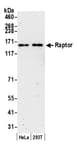 Detection of human Raptor by western blot.