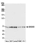 Detection of human and mouse EXOC5 by western blot.