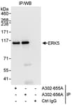 Detection of human ERK5 by western blot of immunoprecipitates.