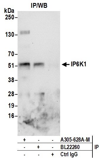Detection of human IP6K1 by western blot of immunoprecipitates.
