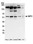 Detection of human and mouse NMT2 by western blot.