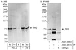 Detection of human and mouse TR2 by western blot (h&amp;m) and immunoprecipitation (h).