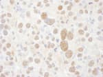 Detection of mouse PSMC2 by immunohistochemistry.