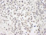 Detection of human BAAT1 by immunohistochemistry.