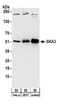 Detection of human SKA3 by western blot.