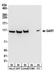Detection of human and mouse GART by western blot.