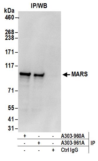 Detection of human MARS by western blot of immunoprecipitates.