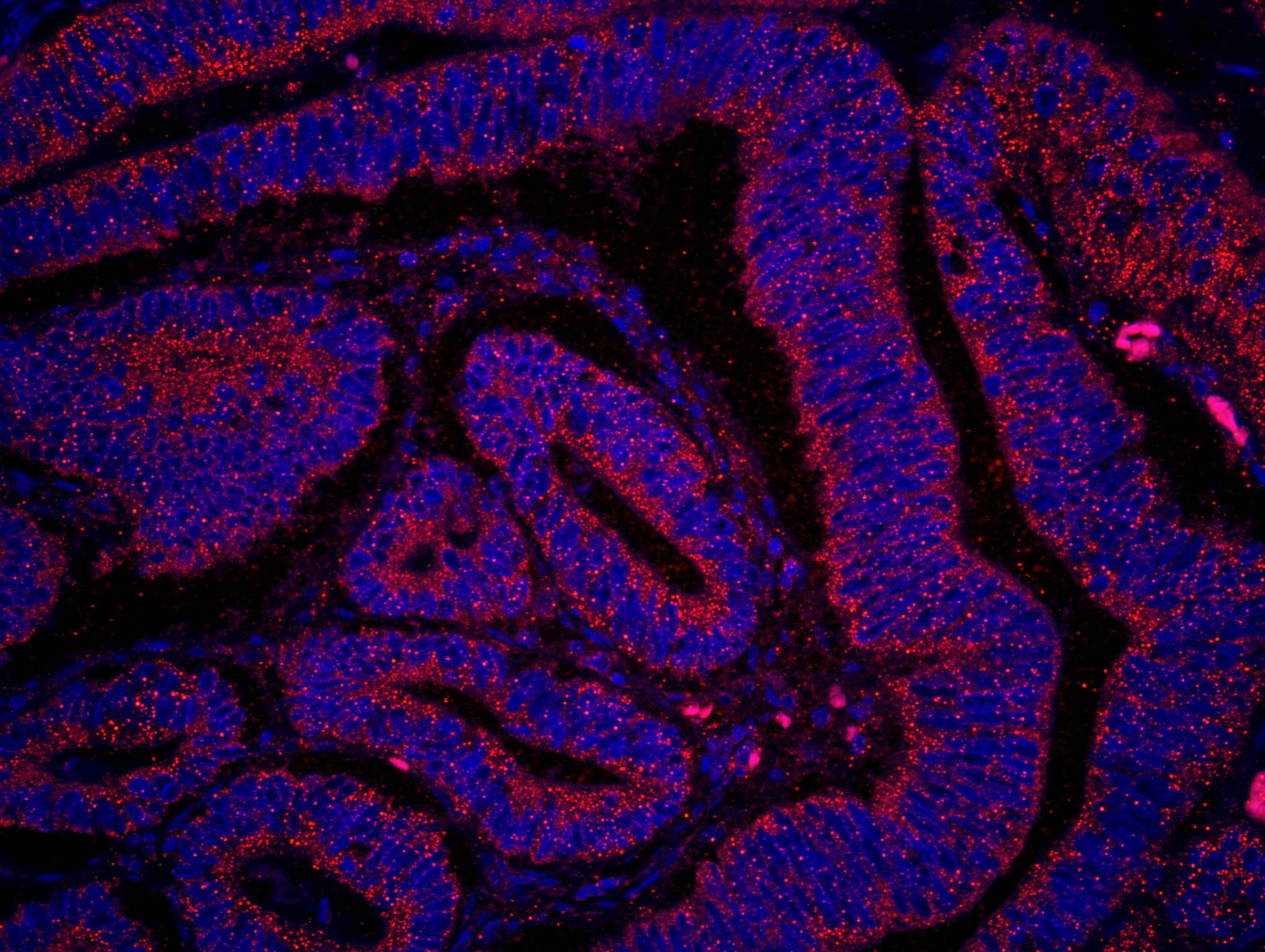 Rabbit anti-PTEN IHC Antibody