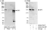 Detection of human ZEB2/SIP by western blot and immunoprecipitation.