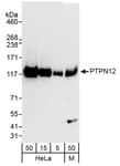 Detection of human and mouse PTPN12 by western blot.