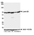 Detection of human Lamin B1 by western blot.
