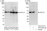 Detection of human and mouse SPTLC1 by western blot (h and m) and immunoprecipitation (h).