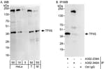 Detection of human and mouse TFIIS by western blot (h&amp;m) and immunoprecipitation (h).