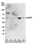 Detection of human and mouse ZIPK by western blot.