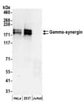 Detection of human Gamma-synergin by western blot.
