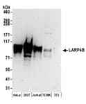 Detection of human and mouse LARP4B by western blot.