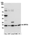 Detection of human and mouse ARPC4 by western blot.