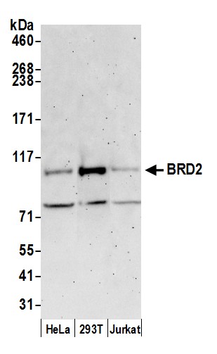 Detection of human BRD2 by immunocytochemistry.
