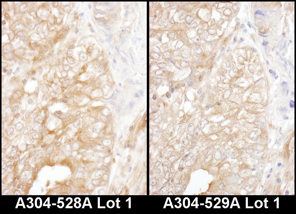 Detection of human DYNC1I2 by immunohistochemistry.