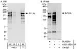 Detection of human BCL9L by western blot and immunoprecipitation.