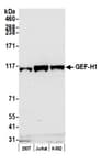 Detection of human GEF-H1 by western blot.